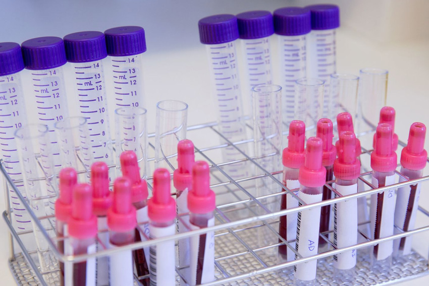 GRUPO HRO - PROTECCIÓN MEDIOAMBIENTAL Y RADIOLOGÍA